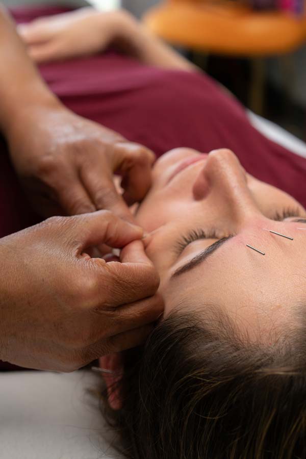 Acupuncture Services in Newtown, PA Acupuncture Services in Newtown, PA