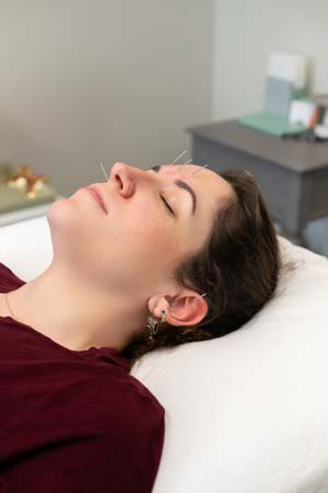 Acupuncture Services in Newtown, PA Acupuncture Services in Newtown, PA