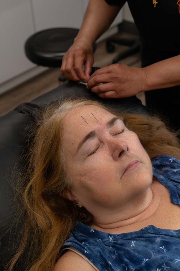 Acupuncture Services in Newtown, PA Acupuncture Services in Newtown, PA