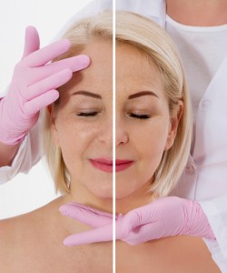 Anti-Aging Treatment Near Me in Newtown, Bucks County PA