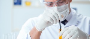 What Is the Dried Urine Test for Comprehensive Hormones (DUTCH)? | Primary Prevention Center in Newtown, PA What Is the Dried Urine Test for Comprehensive Hormones (DUTCH)? | Primary Prevention Center in Newtown, PA