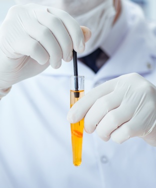 Dried Urine Test for Comprehensive Hormones (DUTCH) Near Me in Newtown, PA